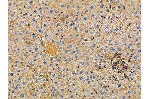 FCRL2 Antibody at 1/100 staining mouse liver tissue by IHC-P.