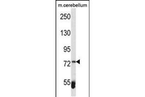 Western blot analysis in mouse cerebellum tissue lysates (35ug/lane). (ZBTB39 anticorps  (AA 231-258))