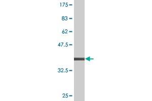 Western Blot detection against Immunogen (36. (CAMK1D anticorps  (AA 1-95))