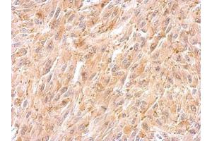 IHC-P Image BCL2L12 antibody detects BCL2L12 protein at cytosol on U87 xenograft by immunohistochemical analysis.