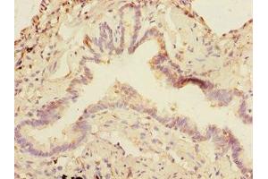 Immunohistochemistry of paraffin-embedded human lung tissue using ABIN7160270 at dilution of 1:100 (DCP1A anticorps  (AA 303-582))