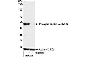 Western Blotting (WB) image for anti-Branched Chain Keto Acid Dehydrogenase E1, alpha Polypeptide (BCKDHA) (pSer292) antibody (ABIN7449282) (Recombinant BCKDHA anticorps  (pSer292))