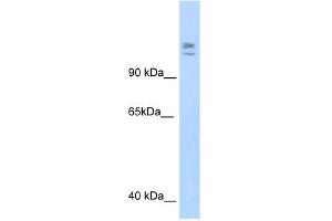 WB Suggested Anti-MYBBP1A Antibody Titration:  1. (MYBBP1A anticorps  (C-Term))