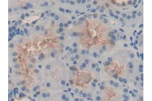 DAB staining on IHC-P; Samples: Human Kidney Tissue (HSPH1 anticorps  (AA 595-733))