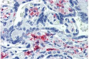 Placenta, Human: Formalin-Fixed, Paraffin-Embedded (FFPE) (CD163 anticorps)