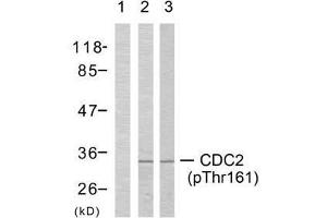 Western blot analysis of extracts from COLO205 cells (Lane 1 and 2) and K562 cells (Lane 3), using CDC2 (phospho-Thr161) antibody (E011134). (CDK1 anticorps  (pThr161))