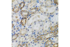 Immunohistochemistry of paraffin-embedded mouse kidney using CASP3 antibody. (Caspase 3 anticorps)
