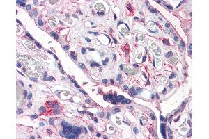 Anti-CD26 antibody IHC of human placenta.