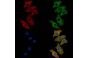 TCIRG1 Mouse Monoclonal Antibody staining Hela cells by IF/ICC.