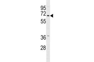 PINK antibody western blot analysis in A549 lysate.