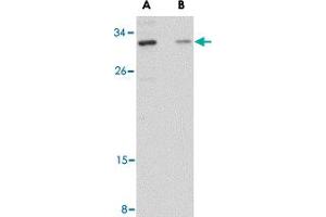 Western blot analysis of GRTP1 in SK-N-SH cell lysate with GRTP1 polyclonal antibody  at 1 ug/mL in the (A) absence and (B) presence of blocking peptide. (GRTP1 anticorps  (Internal Region))