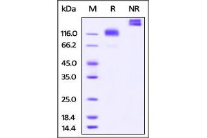 Cynomolgus M-CSF R, Fc Tag on  under reducing (R) and ing (NR) conditions.