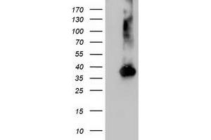 Western Blotting (WB) image for anti-Nudix (Nucleoside Diphosphate Linked Moiety X)-Type Motif 18 (NUDT18) antibody (ABIN1499861) (NUDT18 anticorps)