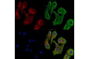 ABIN6256168 and ABIN6267171 staining Hela cells(heat shock treatment) by IF/ICC. (RIPK1 anticorps  (pSer166))