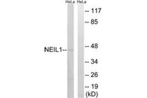 Western blot analysis of extracts from HeLa cells, using NEIL1 Antibody. (NEIL1 anticorps  (AA 291-340))
