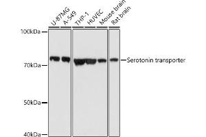 Western blot analysis of extracts of various cell lines, using Serotonin transporter antibody (ABIN7270477) at 1:1000 dilution.