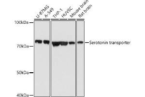 Western blot analysis of extracts of various cell lines, using Serotonin transporter antibody (ABIN7270477) at 1:1000 dilution. (SLC6A4 anticorps  (C-Term))