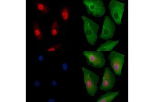ABIN6260374 and ABIN6279100 staining  cells by IF/ICC. (RPP25L anticorps  (C-Term))