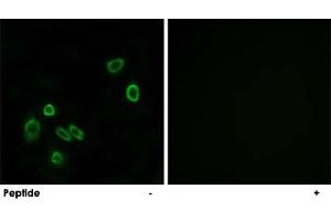 Immunofluorescence analysis of A-549 cells, using BRP44L polyclonal antibody . (BRP44L anticorps  (Internal Region))