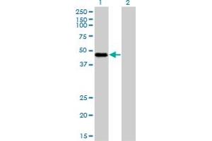 Western Blot analysis of RBM9 expression in transfected 293T cell line by RBM9 monoclonal antibody (M01), clone 4G3.