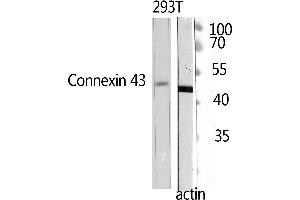 Western Blotting (WB) image for anti-Doublecortin (DCX) (Ser30) antibody (ABIN3184352)
