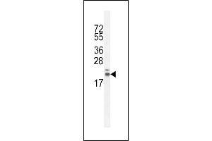 R Antibody (Center) (ABIN654772 and ABIN2844451) western blot analysis in CHO cell line lysates (35 μg/lane). (RNF185 anticorps  (AA 88-117))