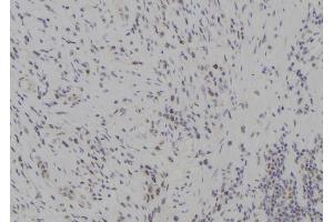 ABIN6277285 at 1/100 staining Human gastric tissue by IHC-P. (TBK1 anticorps  (Internal Region))