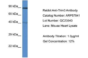 Western Blotting (WB) image for anti-Tripartite Motif Containing 3 (TRIM3) (N-Term) antibody (ABIN2787468) (TRIM3 anticorps  (N-Term))