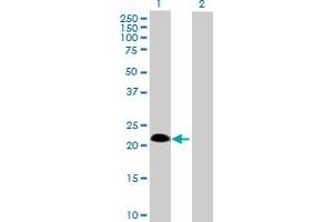 Western Blot analysis of SSPN expression in transfected 293T cell line by SSPN MaxPab polyclonal antibody. (SSPN anticorps  (AA 1-243))