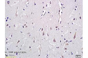 Formalin-fixed and paraffin embedded rat brain tissue labeled with Anti-CD203c Polyclonal Antibody, Unconjugated (ABIN731453) followed by conjugation to the secondary antibody and DAB staining