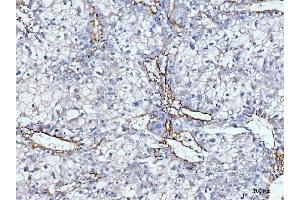 IHC analysis of Collagen VI/COL6A2 using anti-Collagen VI/COL6A2 antibody (ABIN7601439).