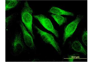 Immunofluorescence of monoclonal antibody to CEACAM6 on HeLa cell. (CEACAM6 anticorps  (AA 156-265))