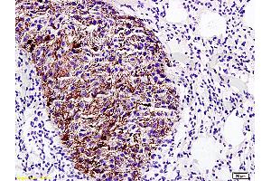 anti-Epithelial Membrane Protein 1 (EMP1) (AA 101-160) antibody