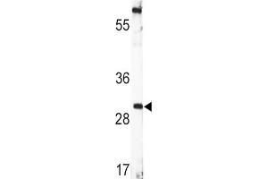 Western Blotting (WB) image for anti-Brain-Derived Neurotrophic Factor (BDNF) antibody (ABIN3003616) (BDNF anticorps)