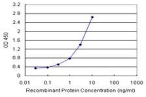 Sandwich ELISA detection sensitivity ranging from 0. (UROS (Humain) Matched Antibody Pair)
