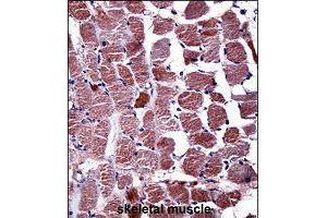 Immunohistochemistry (Formalin/PFA-fixed paraffin-embedded sections) of human skeletal muscle with RGS9 polyclonal antibody  followed by peroxidase conjugation of the secondary antibody and DAB staining. (RGS anticorps  (AA 149-178))