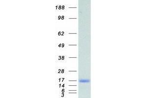 Fatty Acid Binding Protein 5 (Psoriasis-Associated) (FABP5) protein (Myc-DYKDDDDK Tag)