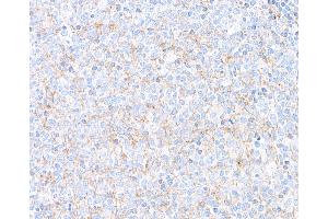 Immunohistochemistry (IHC) image for anti-Hepatitis A Virus Cellular Receptor 2 (TIM 3) (AA 22-201) antibody (ABIN7449550) (Recombinant TIM3 anticorps  (AA 22-201))