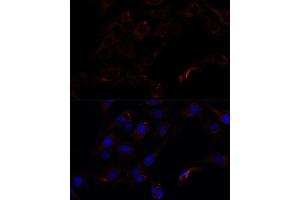 Immunofluorescence analysis of C6 cells using 43716 antibody (ABIN7265350) at dilution of 1:100.