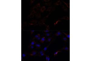 Immunofluorescence analysis of C6 cells using 43716 antibody (ABIN7265350) at dilution of 1:100. (Septin 8 anticorps  (AA 348-427))
