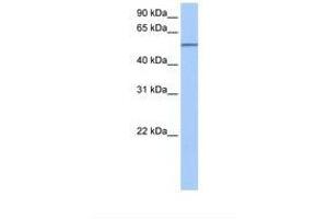 Image no. 1 for anti-Sema Domain, Transmembrane Domain (TM), and Cytoplasmic Domain, (Semaphorin) 6D (SEMA6D) (AA 21-70) antibody (ABIN6738580)