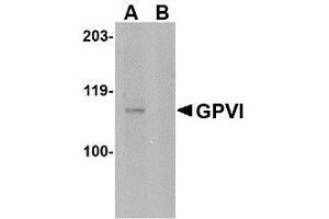Western blot analysis of GPVI in A-20 lysate with AP30379PU-N GPVI antibody at 1μg/ml in either the absence or (B) the presence of blocking peptide. (GP6 anticorps  (Center))
