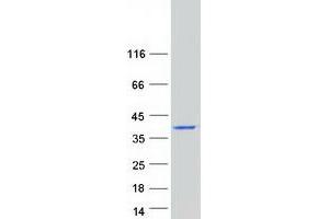Validation with Western Blot