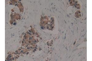 Used in DAB staining on fromalin fixed paraffin- embedded kidney tissue (KRT16 anticorps  (AA 117-419))