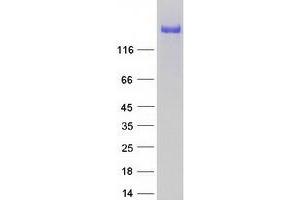 Validation with Western Blot