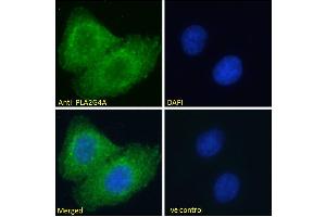 ABIN571180 Immunofluorescence analysis of paraformaldehyde fixed A549 cells, permeabilized with 0. (PLA2G4A anticorps  (Internal Region))