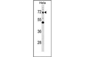 Western blot analysis of Epsin-1  Antibody  in Hela cell line lysates (35ug/lane). (Epsin 1 anticorps  (Middle Region))