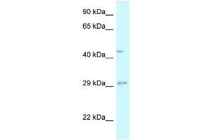 Western Blot showing FUT8 antibody used at a concentration of 1 ug/ml against Fetal Liver Lysate (FUT8 anticorps  (N-Term))