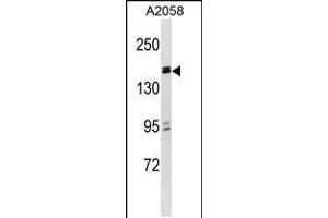 Western blot analysis in A2058 cell line lysates (35ug/lane). (ZBTB38 anticorps  (N-Term))