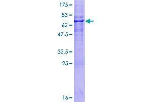 Image no. 1 for Ring Finger Protein 150 (RNF150) (AA 1-314) protein (GST tag) (ABIN1318270)